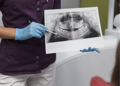 Oral Diagnoz ve Radyoloji