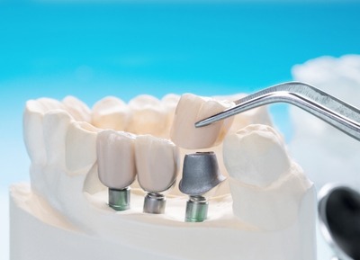 Ağız Diş ve Çene Cerrahisi